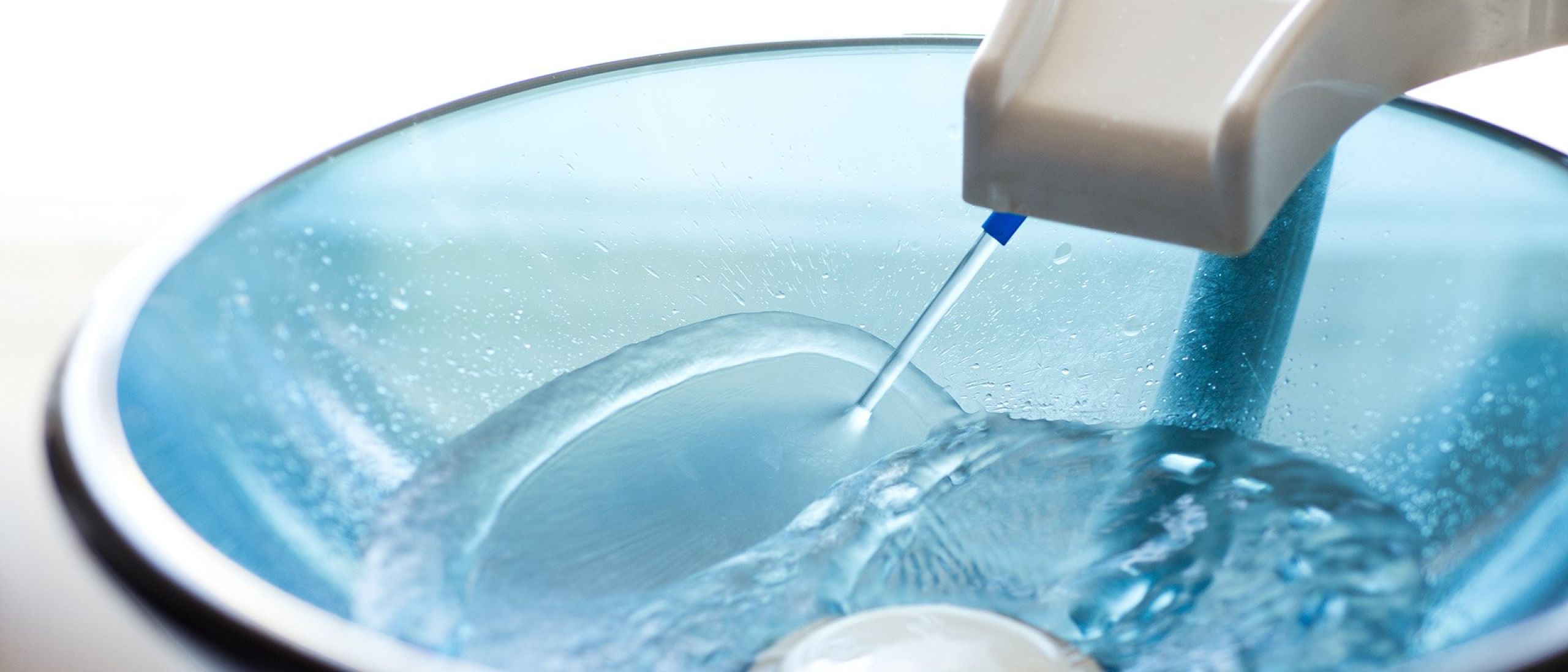 sanificazione impianto idrico acqua